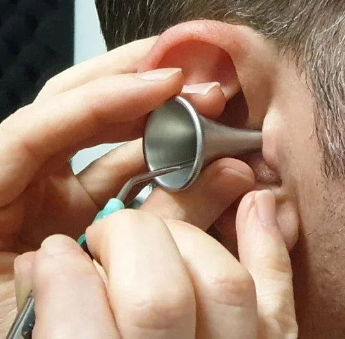 Is Ear Wax Removal Safe? What Perth Patients Should Know Before Booking Comfortable patient care during a professional ear wax removal appointment
